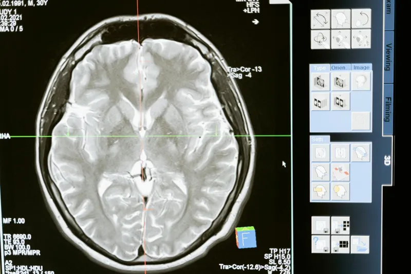 That Left Brain vs Right Brain Test You Took? It's Based on Completely Misunderstood Science