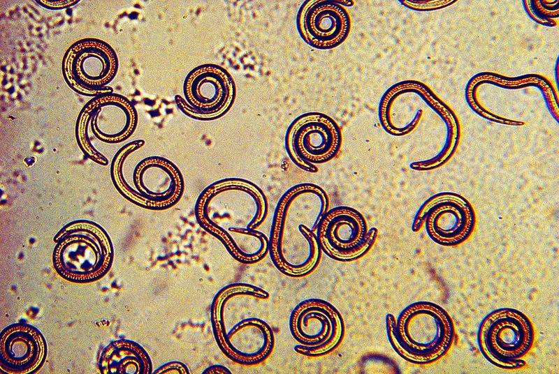 Trichinella spiralis